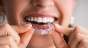 a picture showcasing a clear aligner in the hands of a woman in front of her smiling mouth