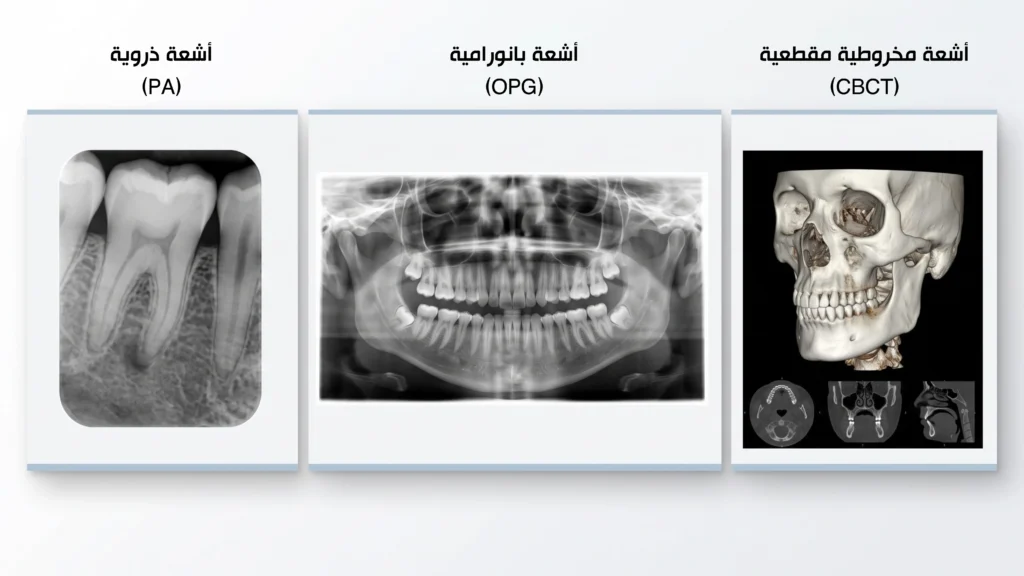 أنواع أشعة الأسنان المتوفرة: البانوراما، المقطعية CBCT، والسيفالومترك.